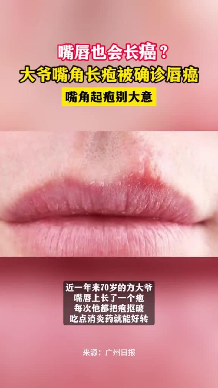 被疫情袭击过的90%的人群都患有不同程度的肺结节】