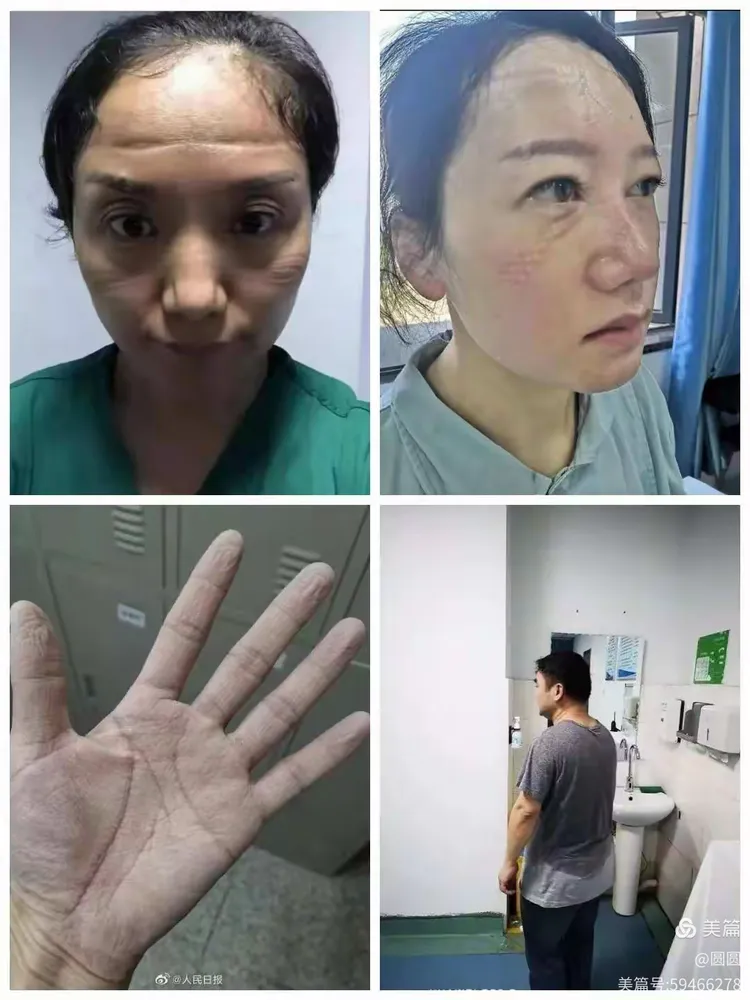 【疫情开端,新冠肺炎疫情开端】